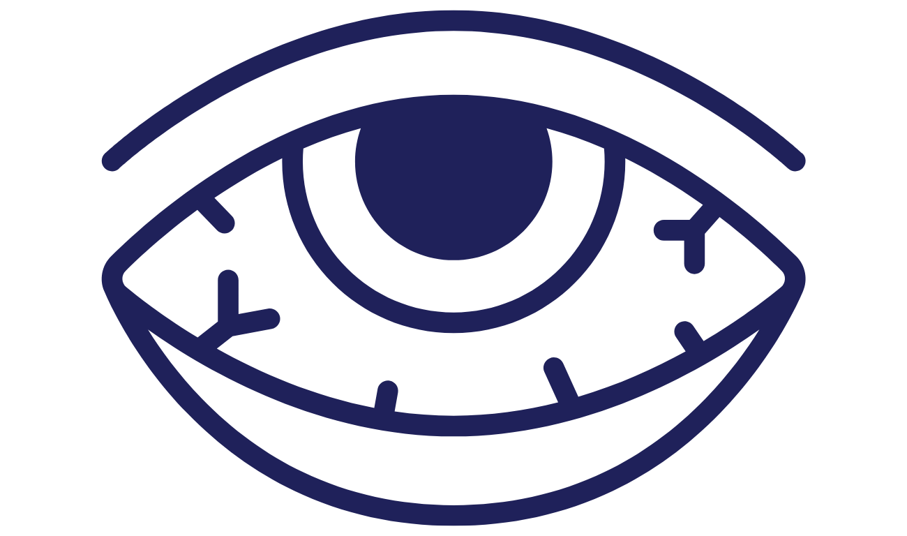 Animated representation of an eye infection