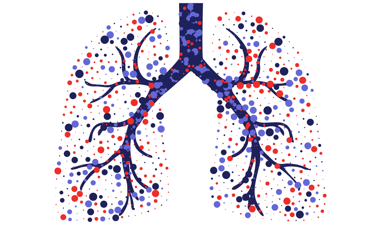 Sinusitis - Website (18)