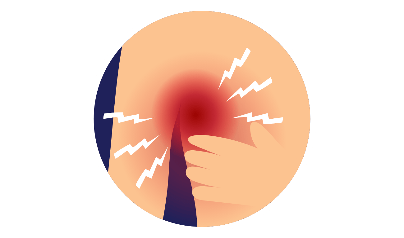 An animation depicting a painful abscess that needs to be drained.